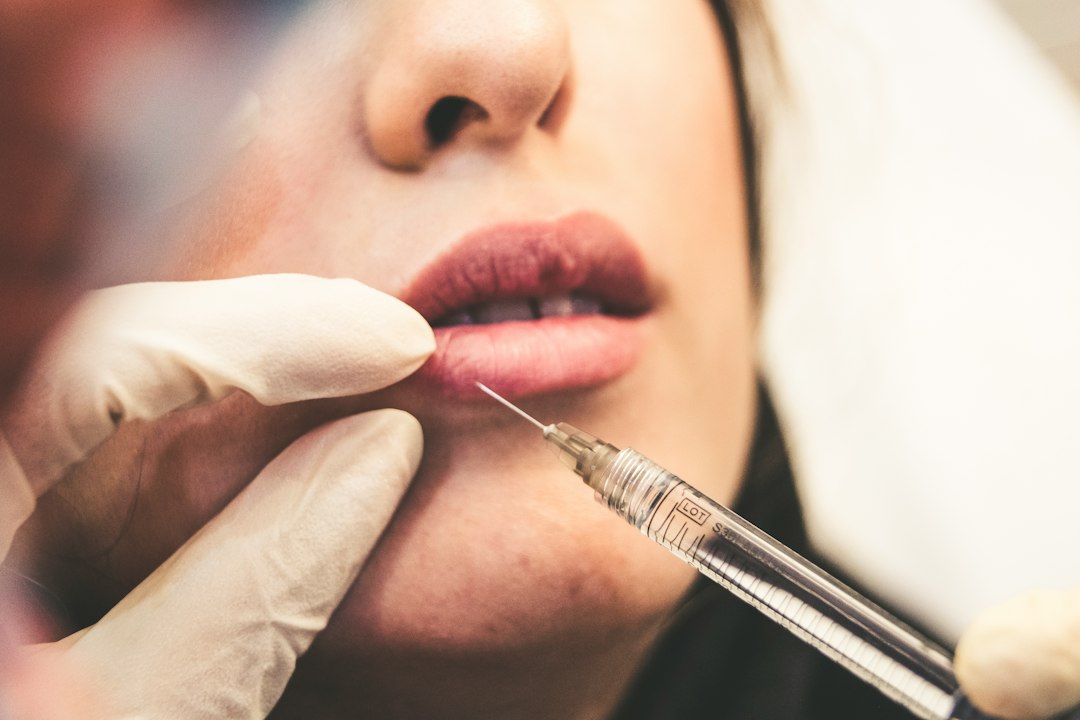 Filler viso e Botox: boom di trattamenti +126% in un anno