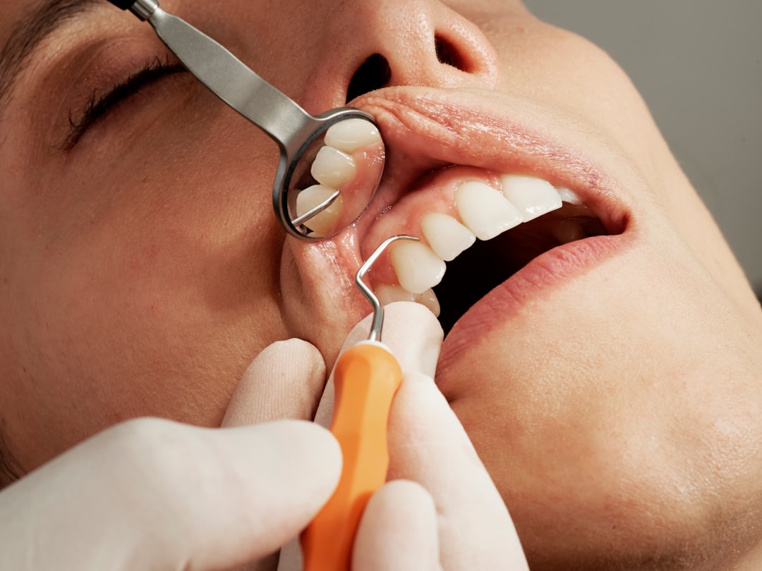Malattie Gengivali e Rischi Cardiovascolari: Il Ruolo Preventivo del Dentista